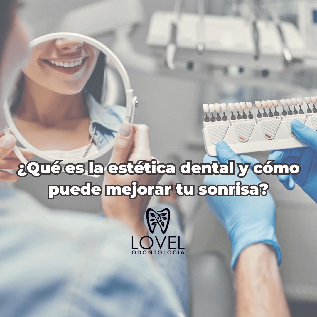 Qu Es La Est Tica Dental Y C Mo Puede Mejorar Tu Sonrisa