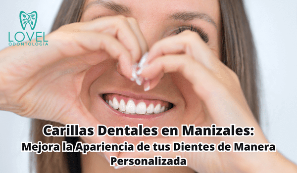 carillas dentales en manizales