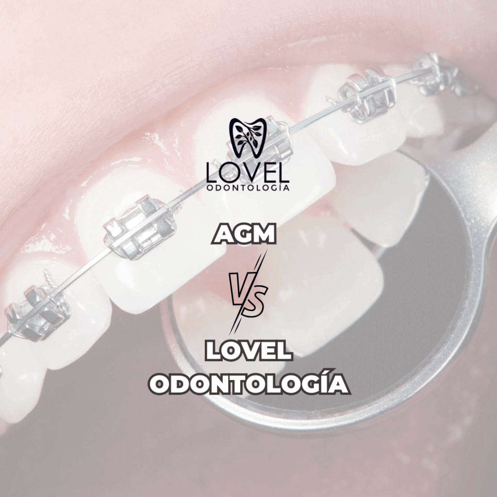 Lovel Odontología VS AGM Odontología ¿Cuál es la mejor opción para tu sonrisa
