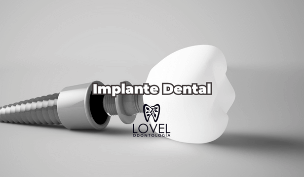 Implante dental