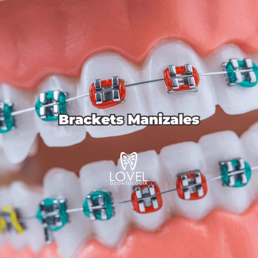 Brackets Manizales