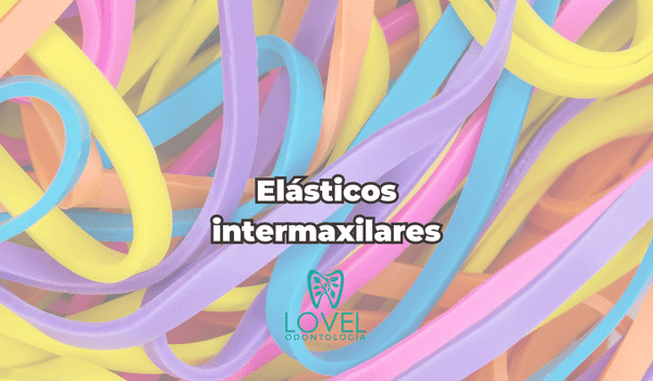 Élasticos intermaxilares