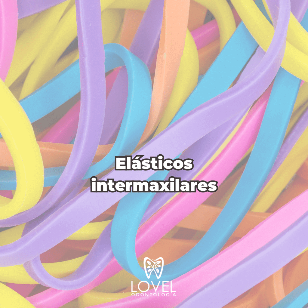 Élasticos intermaxilares