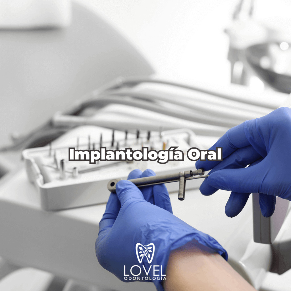 Implantología Oral