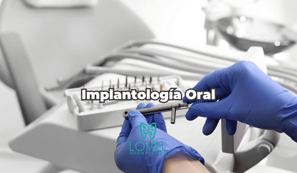 Implantología Oral