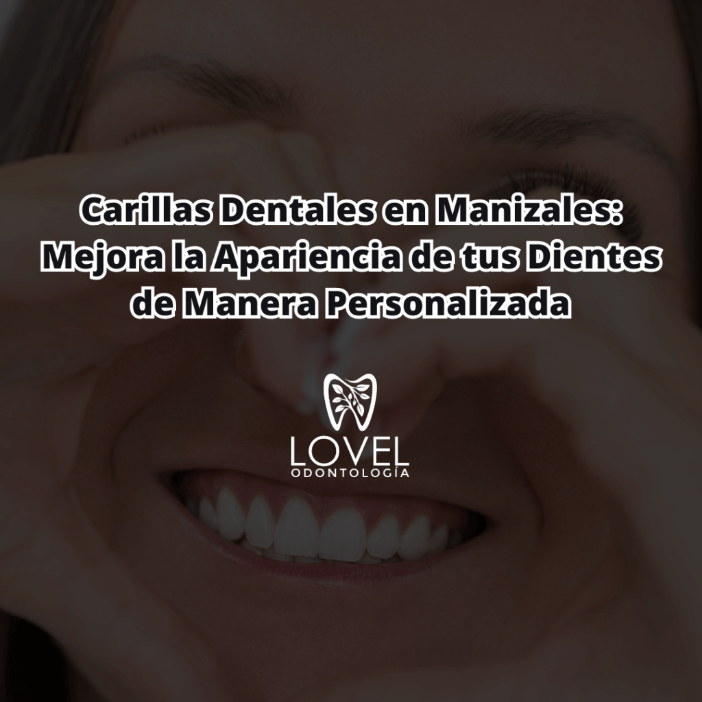 carillas dentales en manizales
