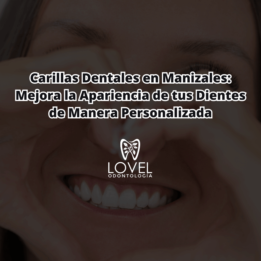 carillas dentales en manizales