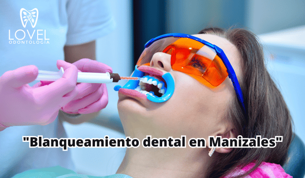 Blanqueamiento dental en Manizales