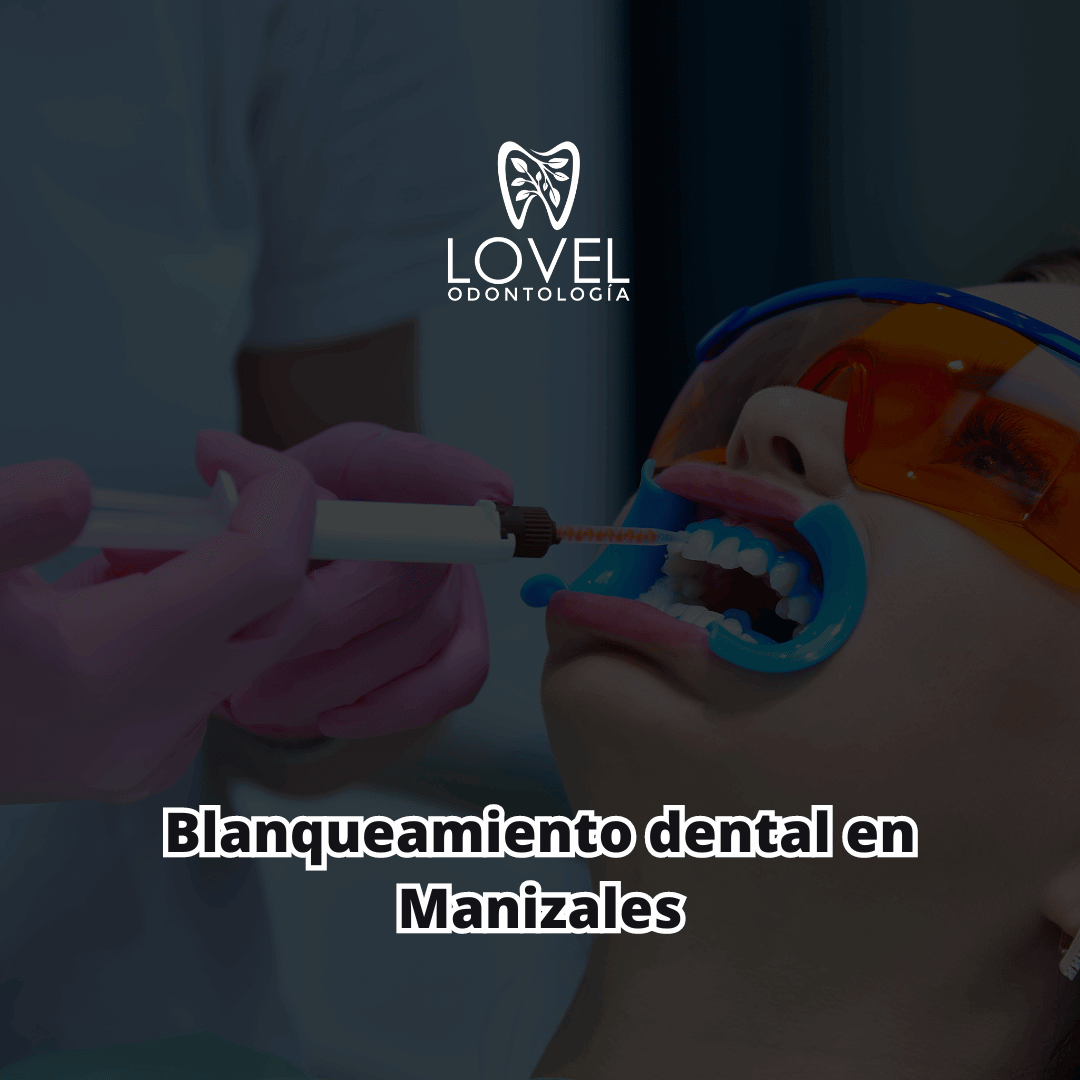 Blanqueamiento dental en Manizales